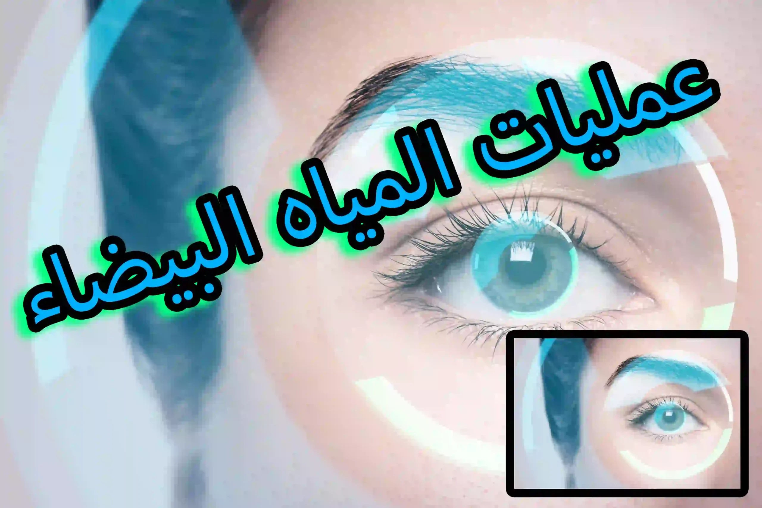 عمليات المياه البيضاء