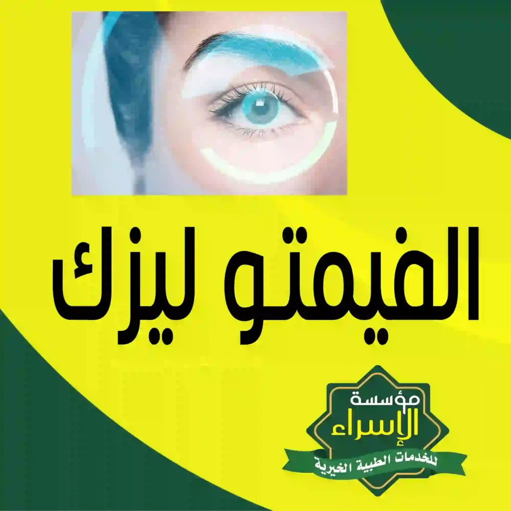 أفضل مركز لعمل عملية الفيمتو ليزك